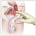 What You Need To Know About Men’s Prostate Health